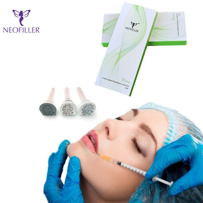 Λεπτό πρόσωπο εγχύσεων υλικών πληρώσεως 1ml 2ml Derm εκτάριο Derm βαθύ Hyaluronic όξινο δερμικό