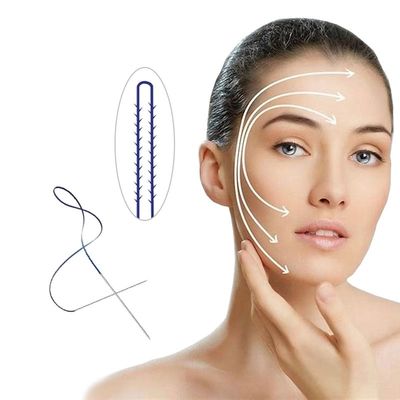 PCL Pdo φρυδιών μονο βίδα 30G 25MM ανελκυστήρων 4d 6d προσώπου ανελκυστήρων του προσώπου περνώντας κλωστή