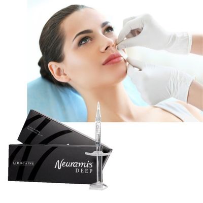 1 ml Neuramis Dermal Filler για επιφανειακή έως βαθιά επεξεργασία βάθους στο πρόσωπο
