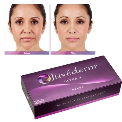 Υαλουρονικό οξύ Juvederm Gel Γεμιστήρας Προσώπου