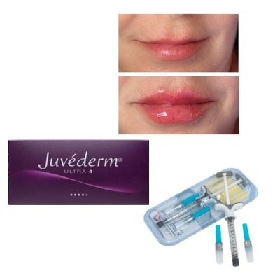 6-9 μήνες διάρκεια Juvederm Dermal Filler Gel για αγορά στο διαδίκτυο και στο κατάστημα