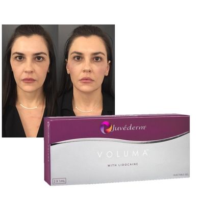 Το Juvederm Dermal Lip Fillers Hyaluronic Acid Cross Linked Injection (Τζουβέντερμ Δερματικά Σφραγίσματα για το Λιπάκι)