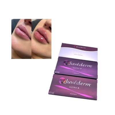 Ενέσιμη Juvederm Voluma Cross Linked Dermal Filler (Περιβληματικό δερματικό γεμιστήρα)