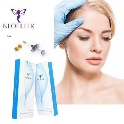 Neofiller 24mg/ml Διασταυρωμένο Υαλουρονικό Οξύ Γεμτικό Για Ενέσεις Προσώπου