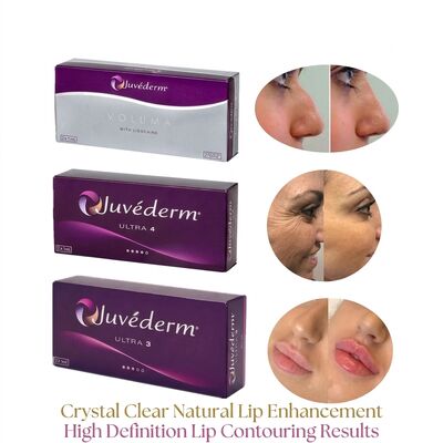 Όγκος της σύριγγας 2 1 ml ανά κουτί Juvederm Voluma Filler Ασφάλεια Προσωπική διαμόρφωση Ενέσιμη δερματική γέμιση για αύξηση του όγκου