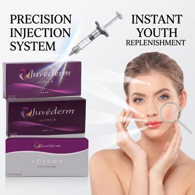 Juvederm Ultra 4 Nose Filler Υαλουρονικό οξύ Δερματικό γεμιστήρα για μη χειρουργική ρινοπλαστική Αναμόρφωση μύτης