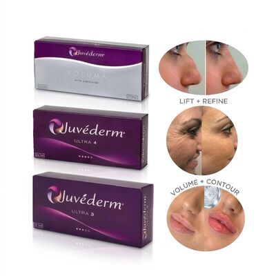 Juvederm Ultra 4 Nose Filler Υαλουρονικό οξύ Δερματικό γεμιστήρα για μη χειρουργική ρινοπλαστική Αναμόρφωση μύτης