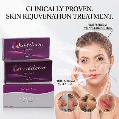 Juvederm Ultra 3 Γέμισμα Ραβδώσεων Ζυγωματικής-Ρινικής (Nasolabial Fold) με Υαλουρονικό Οξύ για Εξομάλυνση των Γραμμών του Χαμόγελου 24mg/ml