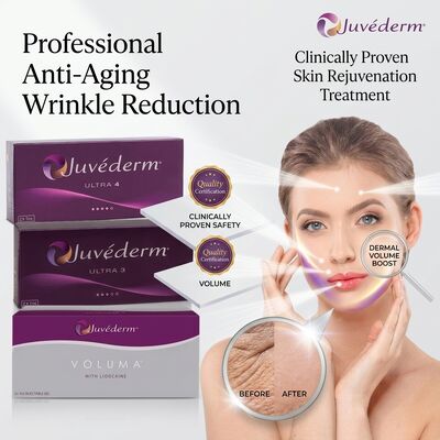 Το Juvederm Ultra 3 Lip Filler Ενέσιμο Υαλουρονικό Οξύ Δερματικό Φιλερ 24mg/ml για τον καθορισμό του όγκου των χειλιών