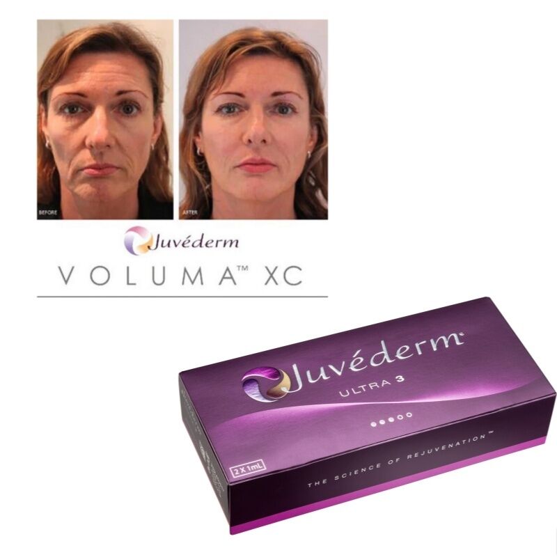 Διόρθωση ρυτίδων Juvederm Dermal Filler Υαλουρονικό οξύ Ενέσιμο τζελ