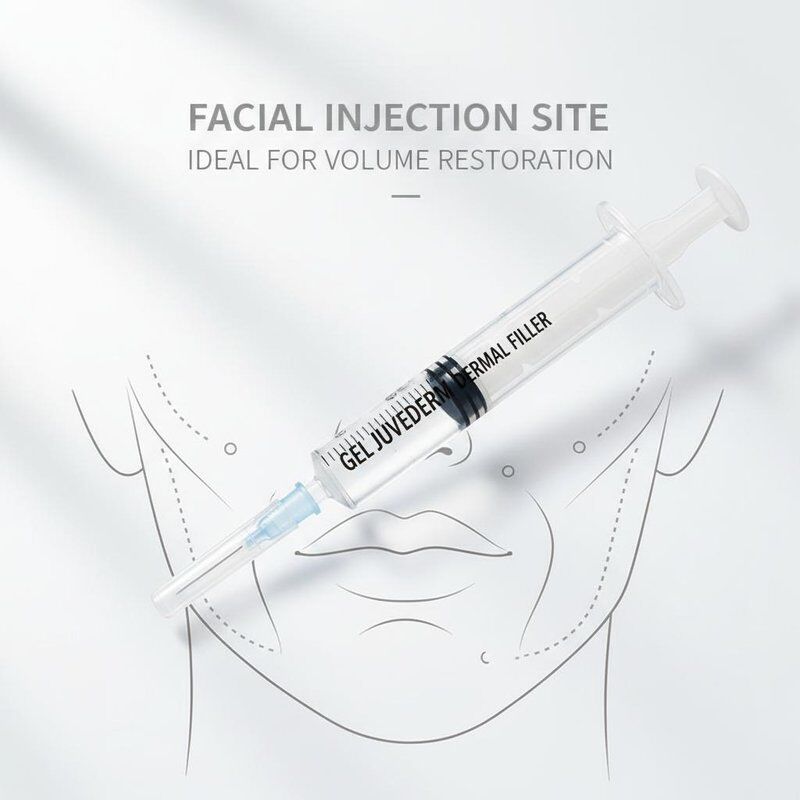 Γέλιο Juvederm Dermal Filler 1ml Σύριγγα Τοποθεσία ενέσεως προσώπου Ιδανικό για διαδικασίες αναζωογόνησης προσώπου και αποκατάστασης όγκου